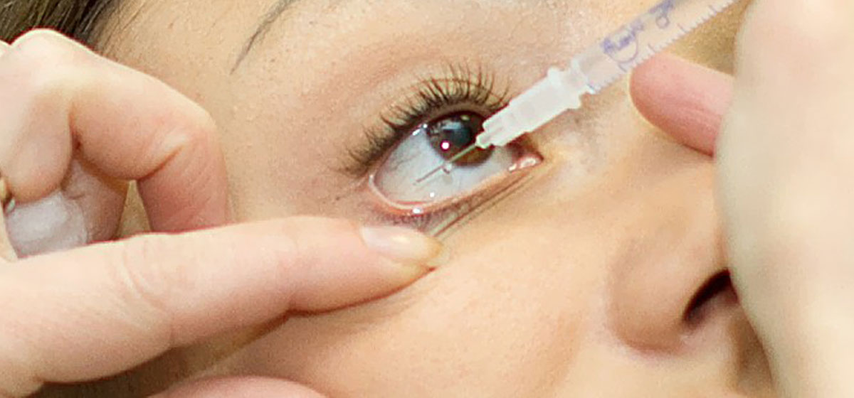 Intravitreal Injections